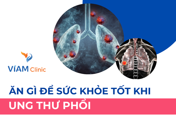 Bị ung thư phổi nên ăn gì để sức khỏe tốt hơn