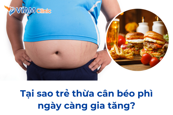 Tại sao trẻ thừa cân béo phì ngày càng gia tăng